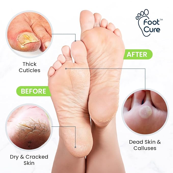 Toenail Fungus Treatment Extra Strength - Image 3