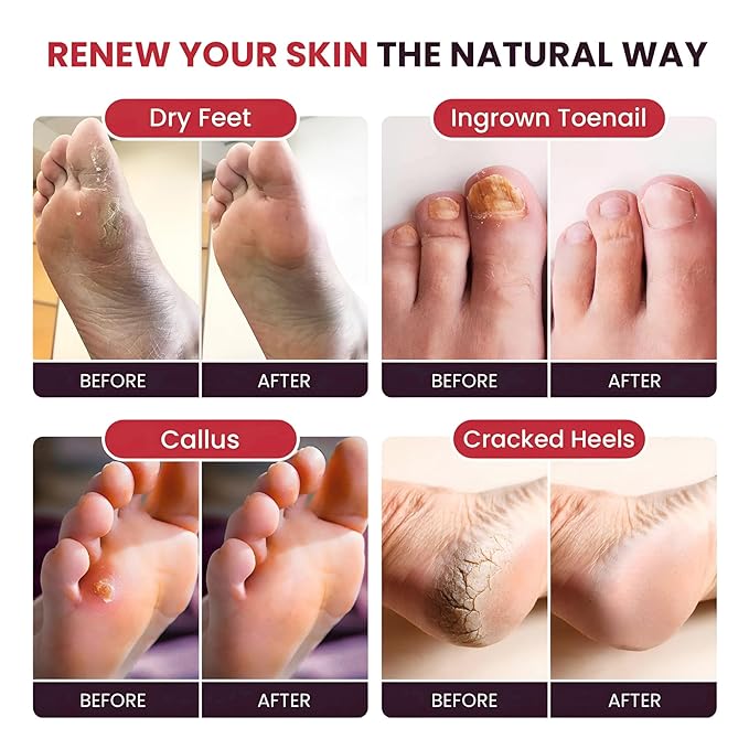 FOOT CURE Tea Tree Oil & Muscle Foot Soak - Image 5