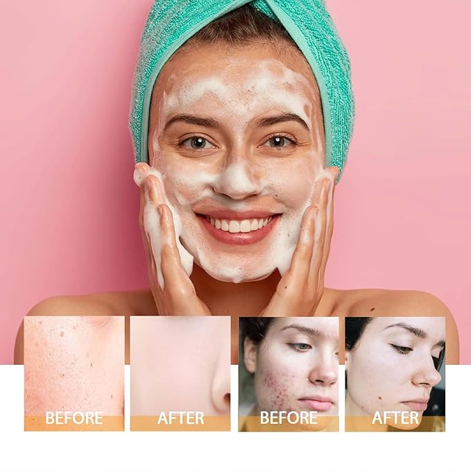 Turmeric Glow Wash Face Wash - Image 5