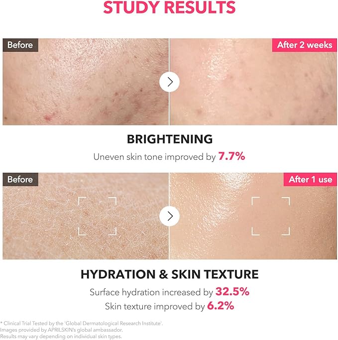 APRILSKIN TXA+Niacinamide 99 Pink Milky Toner | 99% High-Purity TXA 3%+ - Image 5