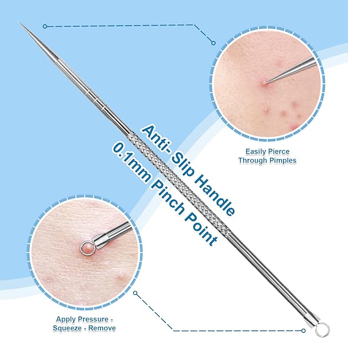 Stainless Steel Blackhead Remover, Pimple Extractor, Pimple Popper, Comedone - Image 2