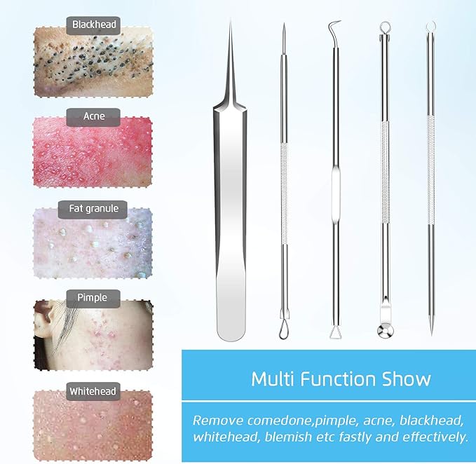 Best Blackhead Remover, Acne Whitehead Removal Kit, Pimple Comedone Extractor - Image 2