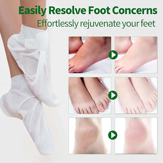 5 Pack Moisturizing Foot Mask, Hydrating Foot Masks - Image 4