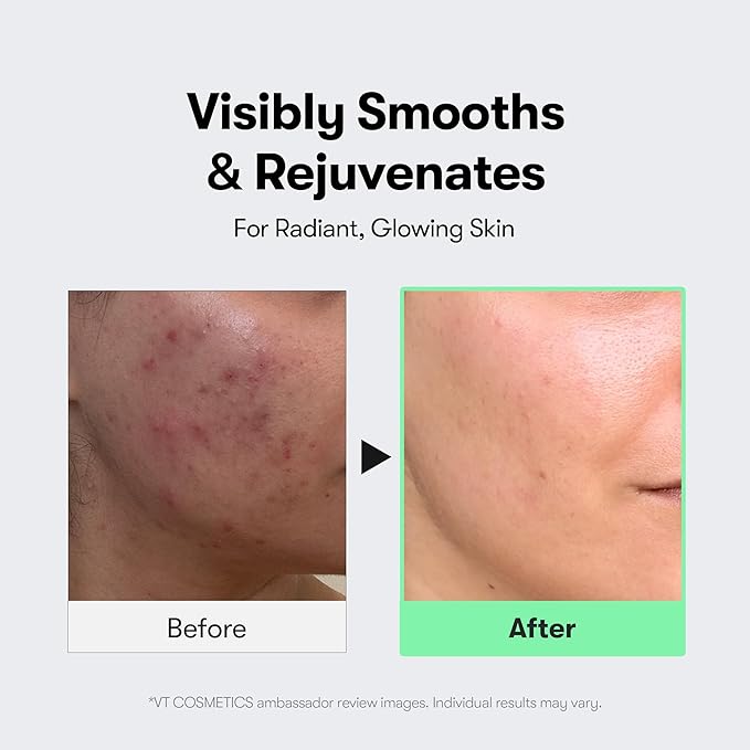 VT COSMETICS CICA Reedle Shot 100, Spicule Microneedling Serum - Image 5