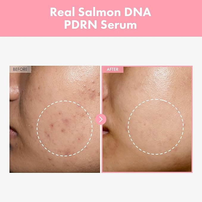 TOSOWOONG Pink Peptide 12 PDRN Serum - Image 2