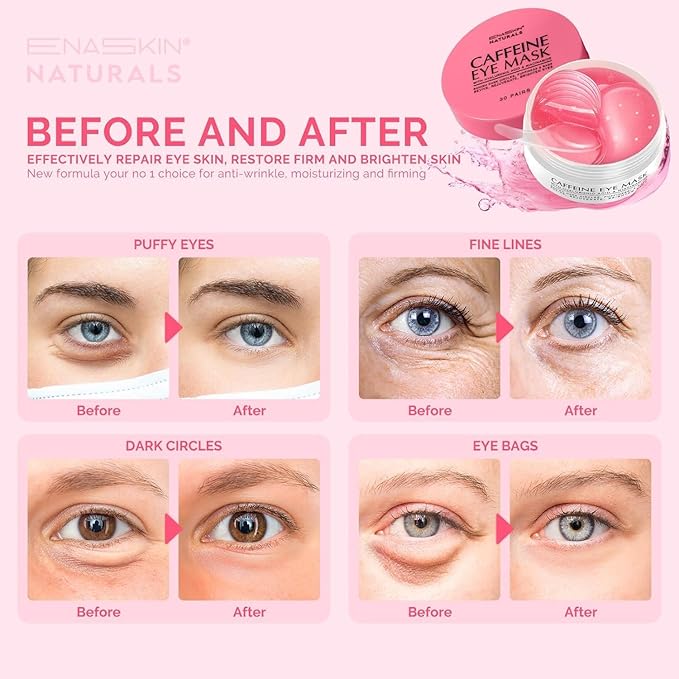 Under Eye Patches for Puffiness and Dark Circles: Caffeine Gel Masks for - Image 6