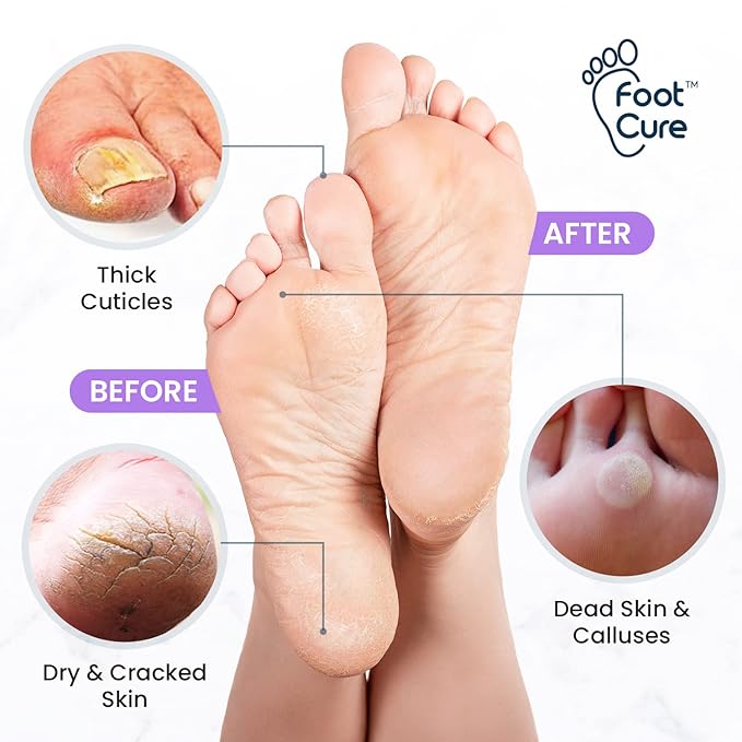 Lavender Foot Soak & Callus Remover Gel Kit - Image 3