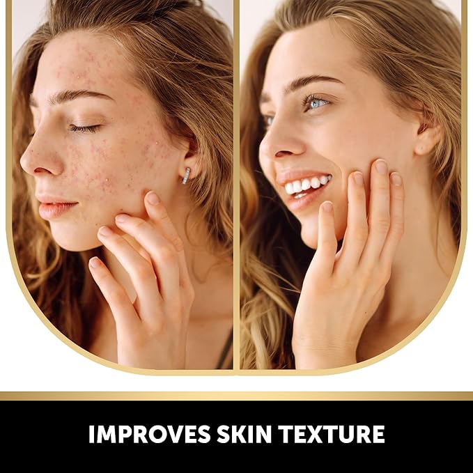 VALITIC 2 Pack Kojic Acid Vitamin C & Retinol Soap Bars - Image 3