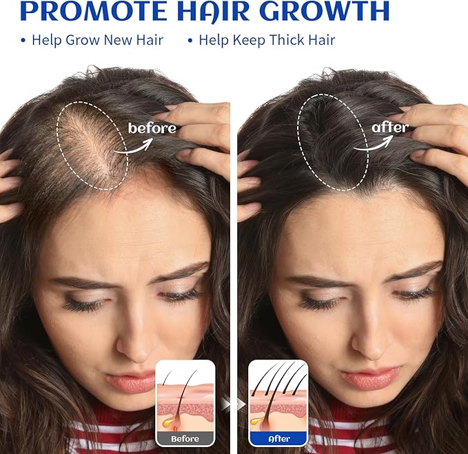 HIQILI Rosemary Oil for Hair Growth, Add to Shampoo & Conditioner, 100% Pure - Image 2