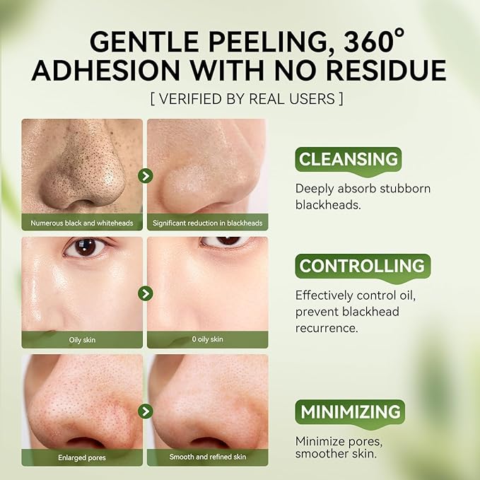 LANBENA 3-in-1 Blackhead Removal Set - Image 6