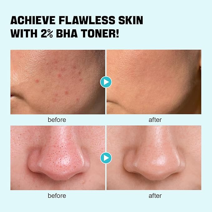 ZealSea 2% Salicylic Acid Toner - Image 3