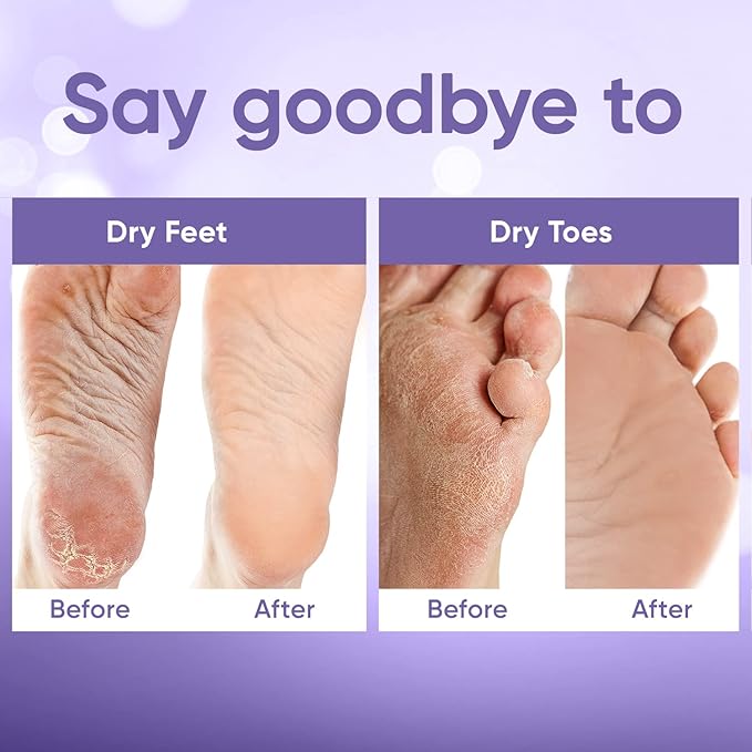 CÉLOR Foot Peeling Mask for Dry Cracked Feet | Foot Mask to Exfoliate Rough - Image 4