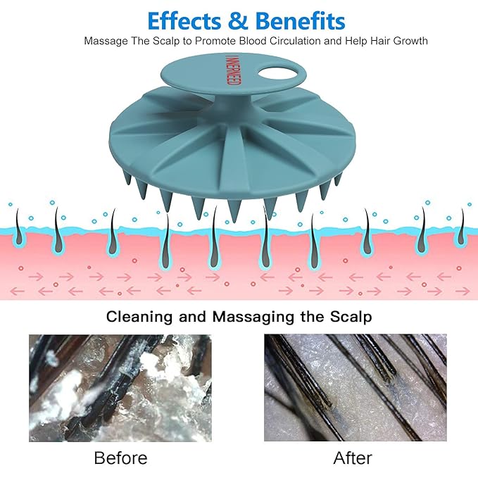Scalp Massager Shampoo Brush, Wet & Dry Manual Scalp Care Head Scrubber Hair - Image 4