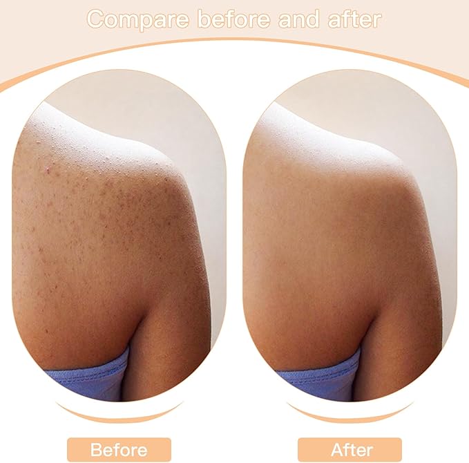 2 Pack Exfoliating Body Brushes - Image 7