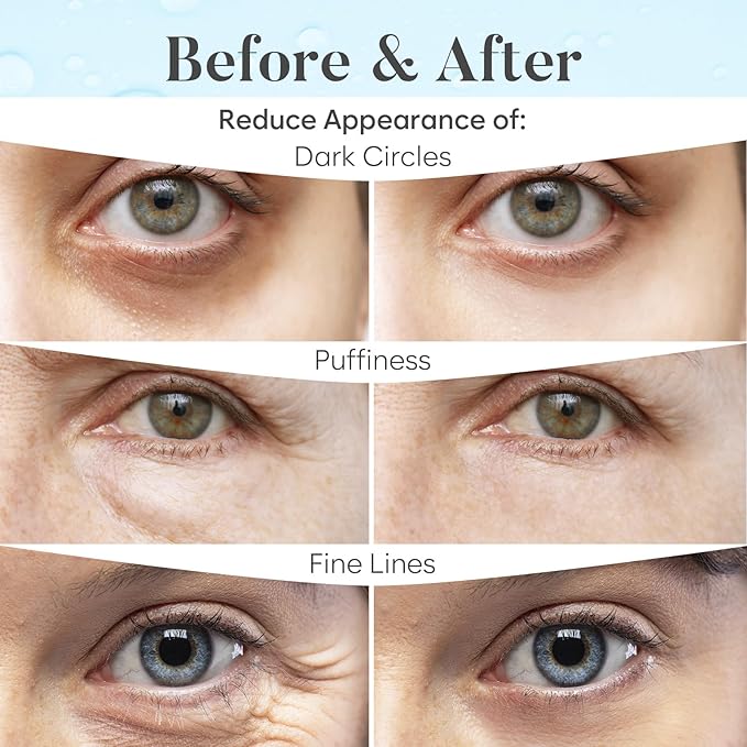 BLOOMORA Marine Collagen Under Eye Patches, - Image 4