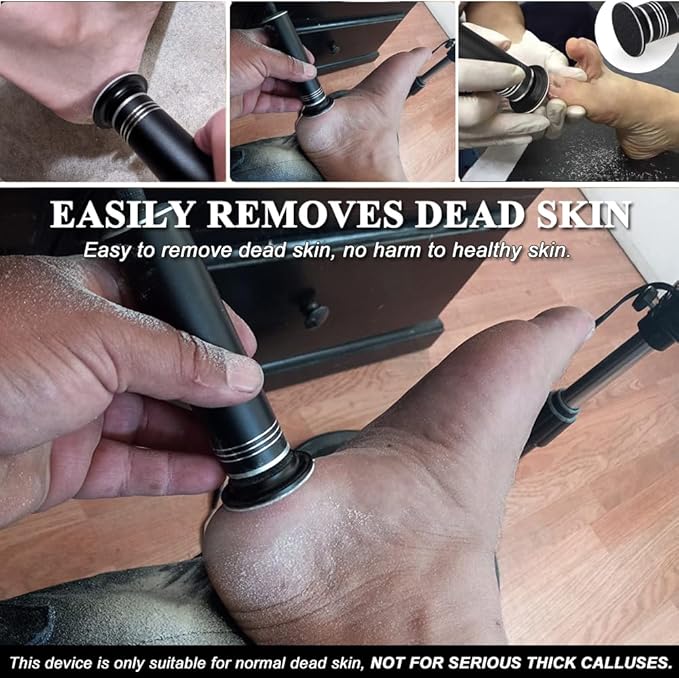 Upgraded Electric Callus Remover - Image 4