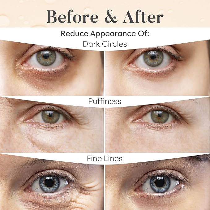 AURAE Caffeine Under Eye Patches - Image 4