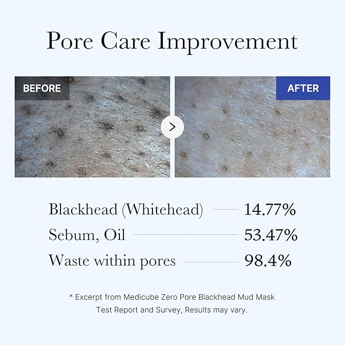 Medicube Zero Pore Blackhead Mud Facial Mask - Image 5