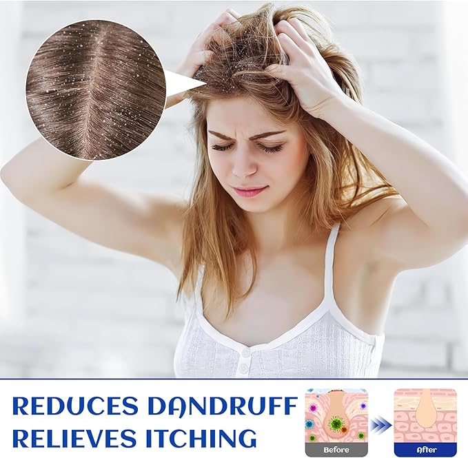 HIQILI Rosemary Oil for Hair Growth, Add to Shampoo & Conditioner, 100% Pure - Image 4