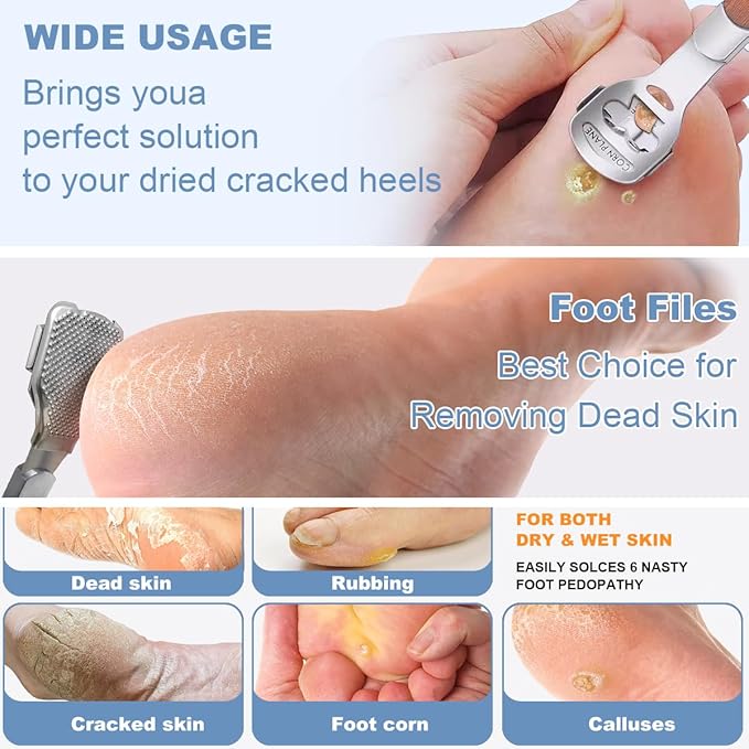 36 Pcs Callus Shaver for Feet Set, Foot Callus Shaver - Image 4