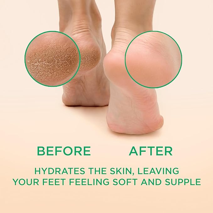 Lee Beauty Professional Callus Remover - Image 2
