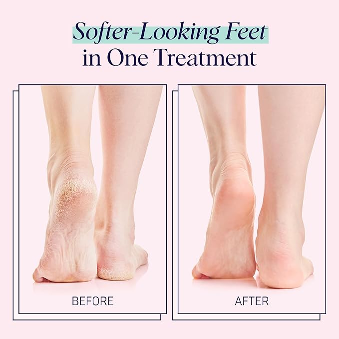 SpaLife Moisturizing Foot Sockies | Mothers Day Gifts & Foot Mask - Image 6