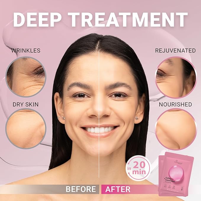 VIABEAUTY 8 Pack of Collagen Face Mask - Image 2