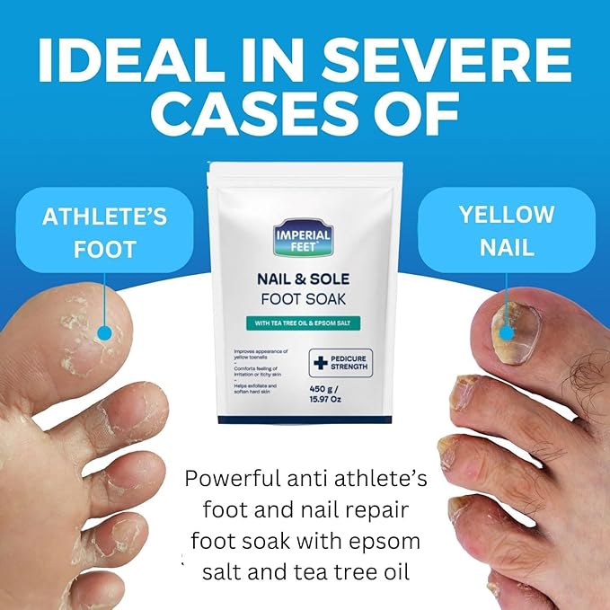 Imperial Feet Epsom Salt Foot Soak-Toenail Repair, Fungus Athletes Foot - Image 7