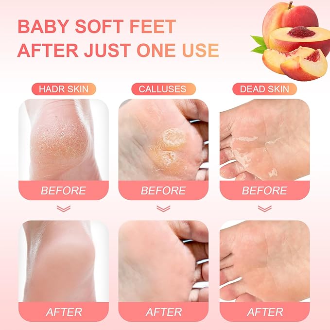 Foot Peeling Mask Exfoliant for Peeling Off Calluses, Natural Exfoliator for - Image 4
