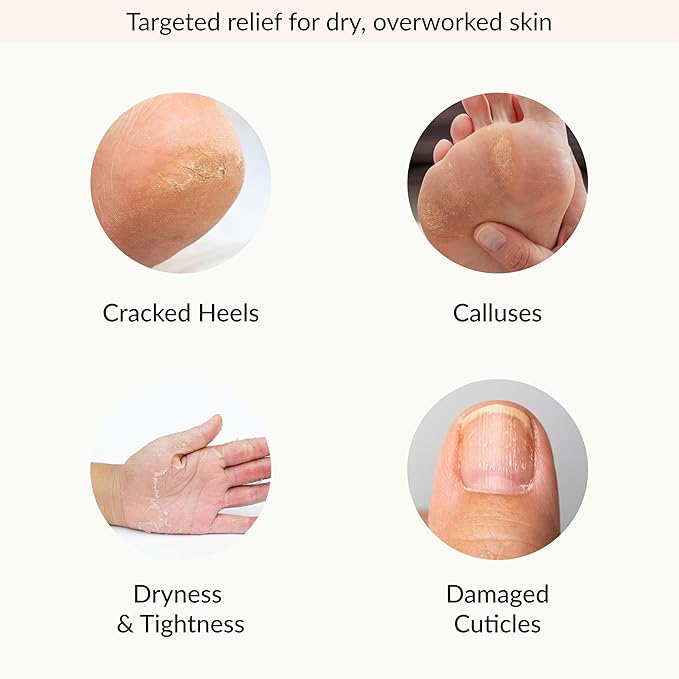 Epielle Hydrating & Moisturizing Hand & Foot Masks, Relieve and Soften Dry - Image 4