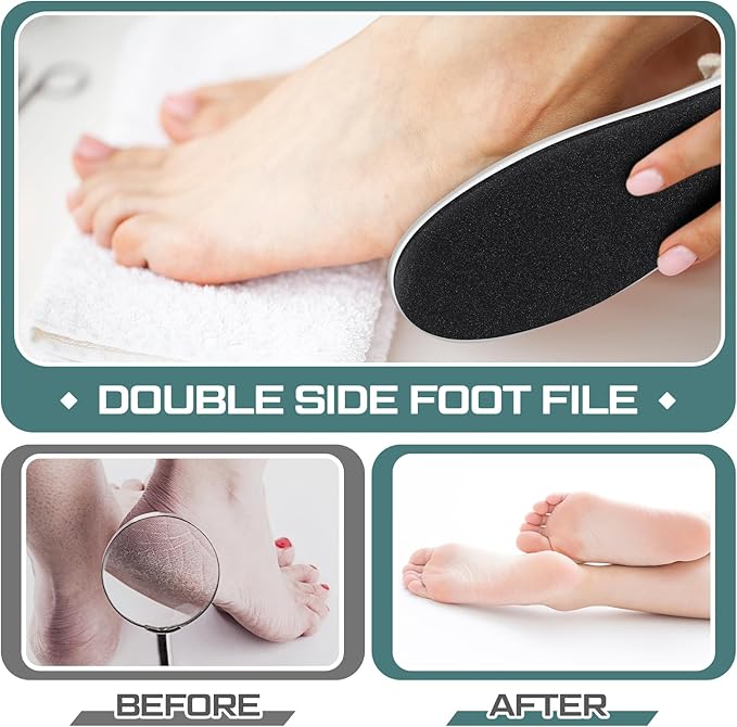 Lothee 15 Pack Foot File Foot Callus Remover Double Sided Professional - Image 5