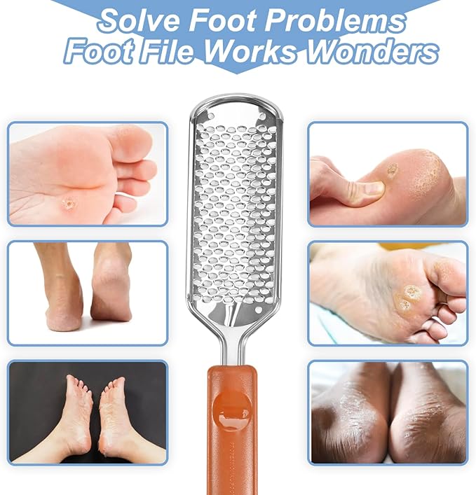 Professional Foot Scrubber Dead Skin Remover, Pedicure Foot File Callus Removal - Image 3