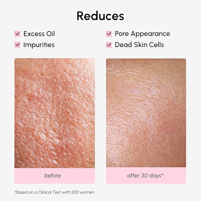 MAREE Pore Minimizer for Face Toner – Witch Hazel Toner - Image 5