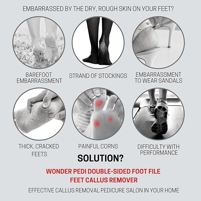 Made in Germany Double Sided Foot File Callus Remover, Stainless Steel and - Image 2