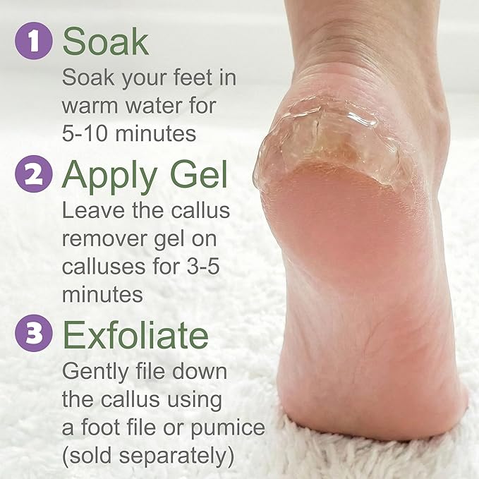 Callus Remover for Feet Foot Callus Remover Gel, Spa Foot Care, Pedicure Tools - Image 6