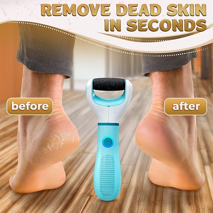 Electric Foot Sander Callus Remover – 3-Speed Foot Sanders - Image 5