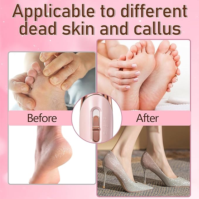 Callus Remover for Feet，Electric Foot Callus Remover - Image 4