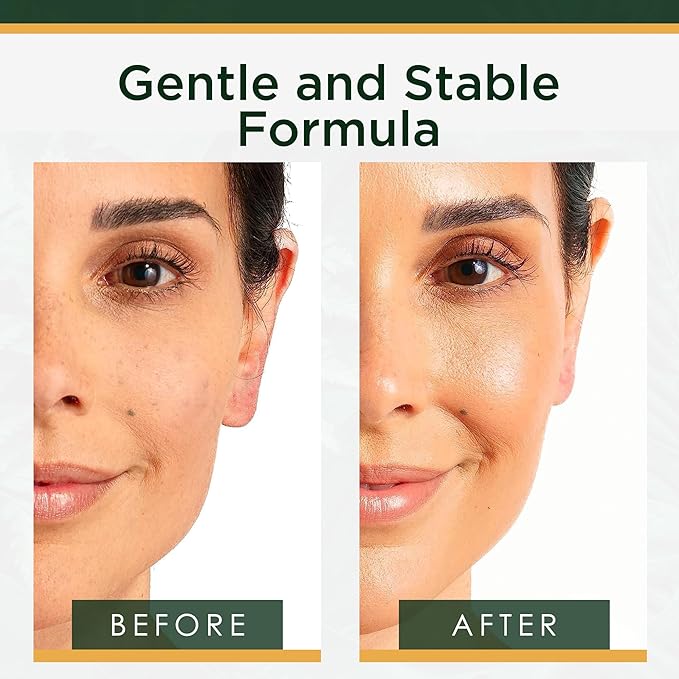 Tree of Life Vitamin C Serum For Face - Image 3