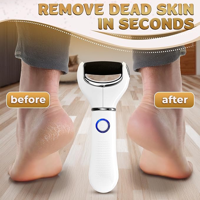 Electric Foot File Callus Remover – 3-Speed Foot Scrubber Electric, Dry Skin - Image 5