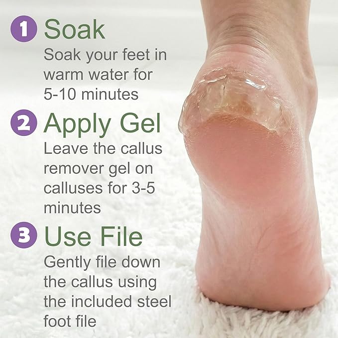 Callus Remover Gel & Double-Sided Foot File: 8 oz Extra Strength Callus Remover - Image 6