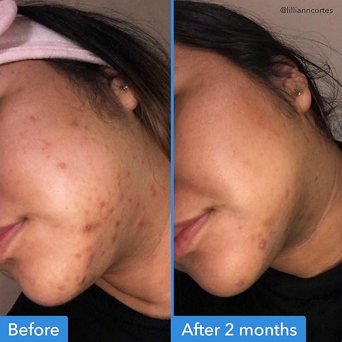 Good Molecules Discoloration Correcting Serum Pack 2 – 30 ml Each | Tranexamic - Image 3