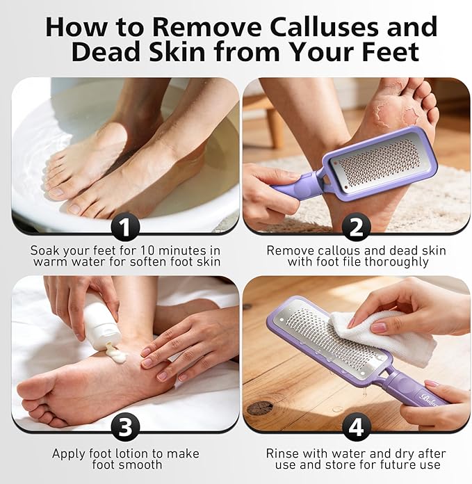 BALUCA Professional Foot File & Callus Remover - Image 8
