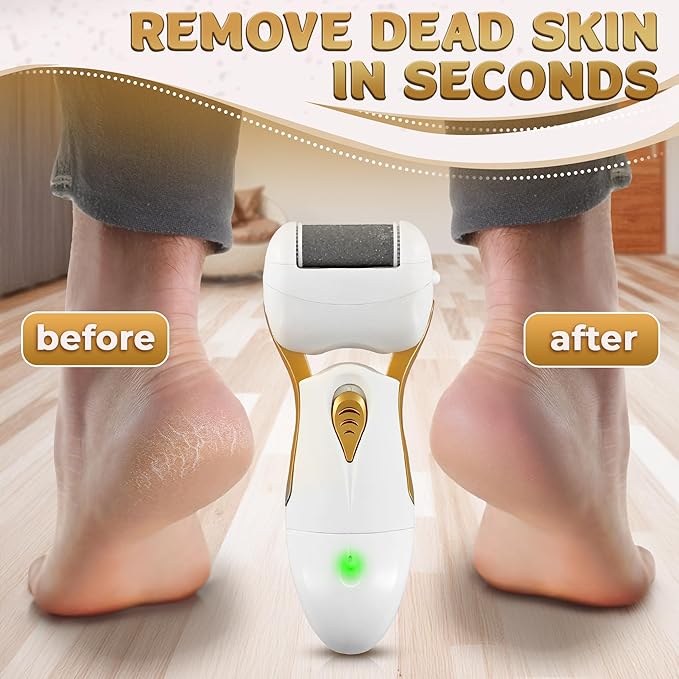 Electric Callus Remover for Feet – Electric Foot Filer - Image 6