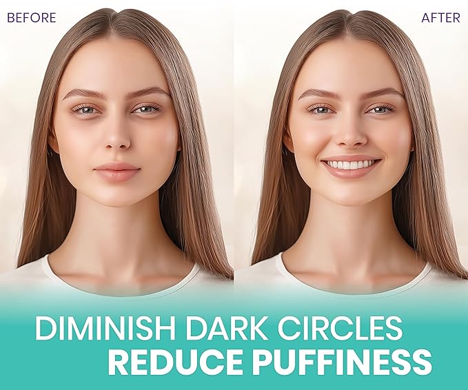 Stylia Under Eye Patches for Puffy Eyes and Dark Circles - Image 2