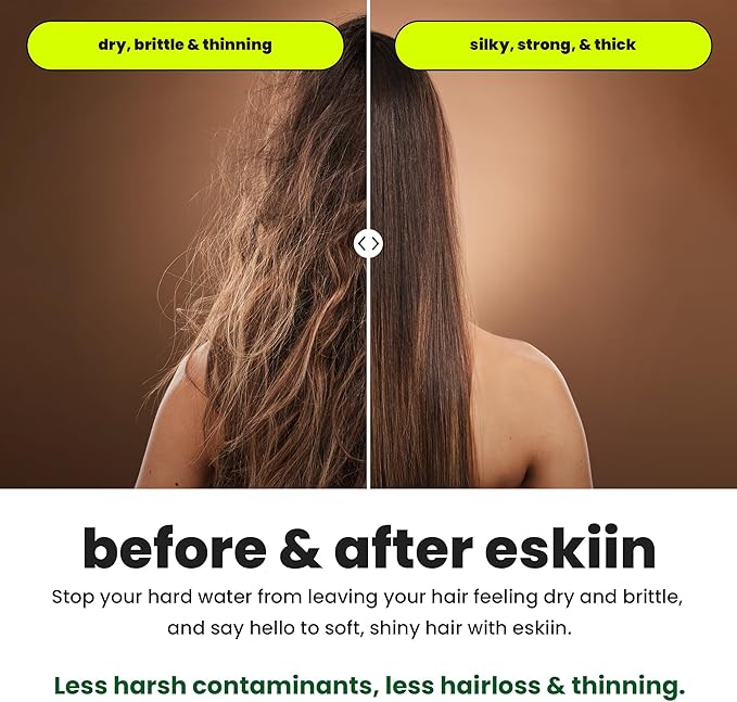 Eskiin Filtered Showerhead - Image 3